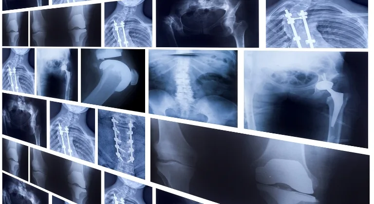 Rogobete anunță că sistemul medical va fi mai conectat și mai rapid