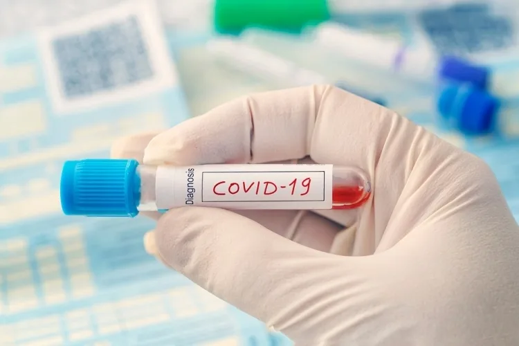 Tătaru:"Laboratoarele care nu vor da rezultatul testelor pentru depistarea infecției cu noul coronavirus în 24 de ore vor ieși din programul de testare"