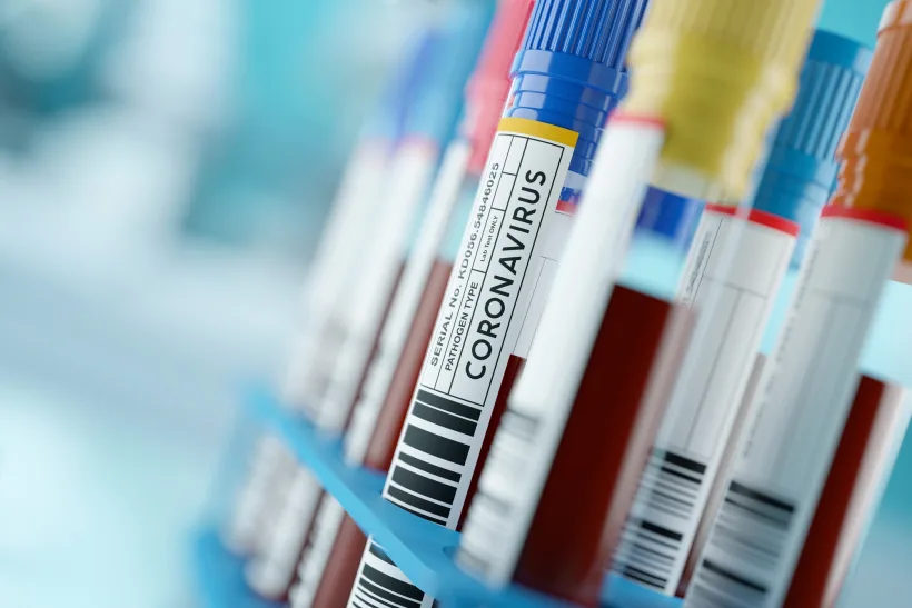 Vaccinul împotriva Covid-19 dezvoltat de compania americană de biotehnologie Inovio, a intrat deja în faza de experimentare pe om