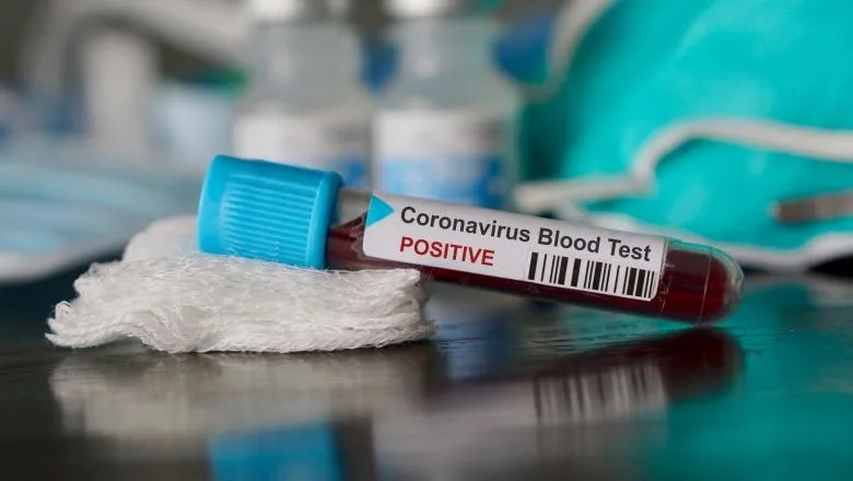 SUA a dat acordul pentru testarea unui nou medicament pentru coronavirus
