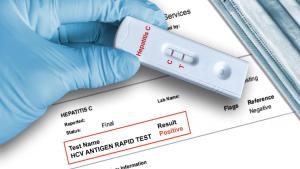 Hepatita B și C: românii pot fi testați gratuit, cu bilet de trimitere de la medic