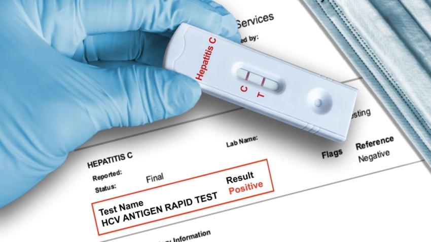 Hepatita B și C: românii pot fi testați gratuit, cu bilet de trimitere de la medic